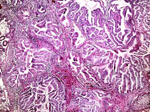 Endometrial Biopsy - 20x